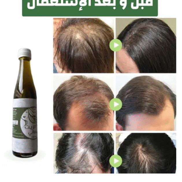 الزيت الافغاني لحل جميع  مشاكل الشعر