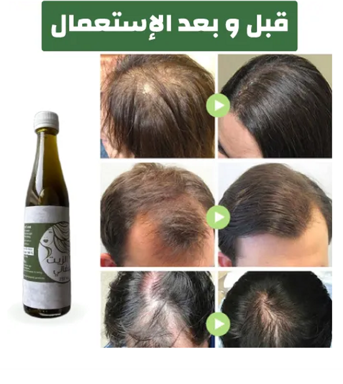 الزيت الافغاني لحل جميع مشاكل الشعر